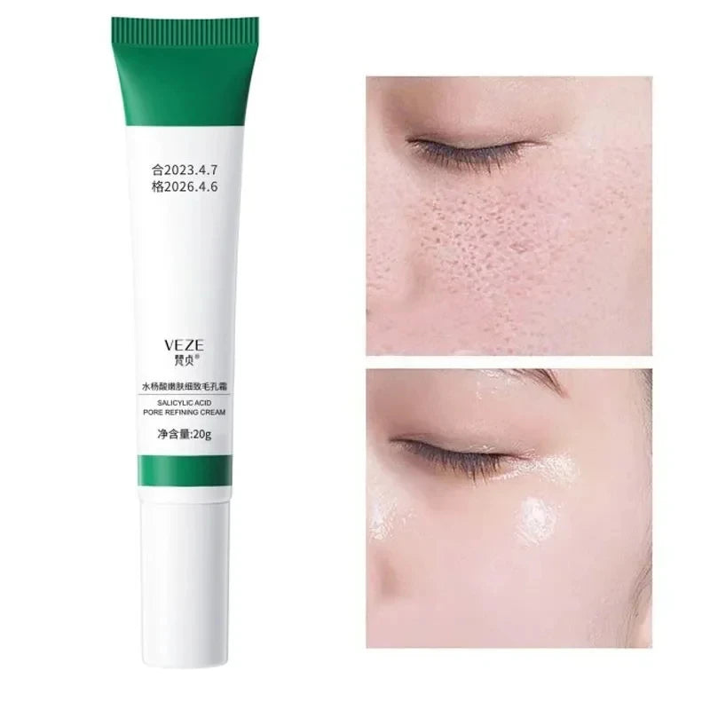 Salicylic Acid Pore Minimizing Cream – Blackhead Remover & Oil Control Face Cream