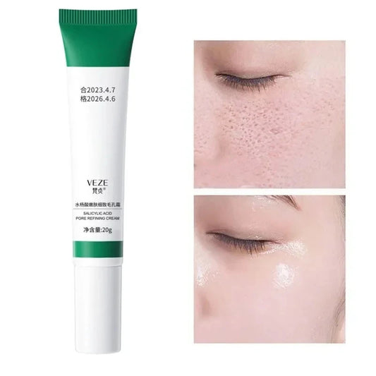 Salicylic Acid Pore Minimizing Cream – Blackhead Remover & Oil Control Face Cream