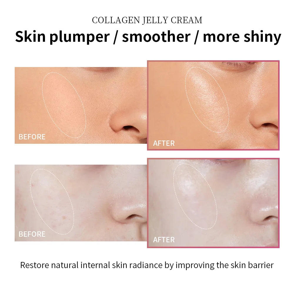 Collagen Jelly Cream with Niacinamide – Brightening & Deep Moisturizing Face Cream