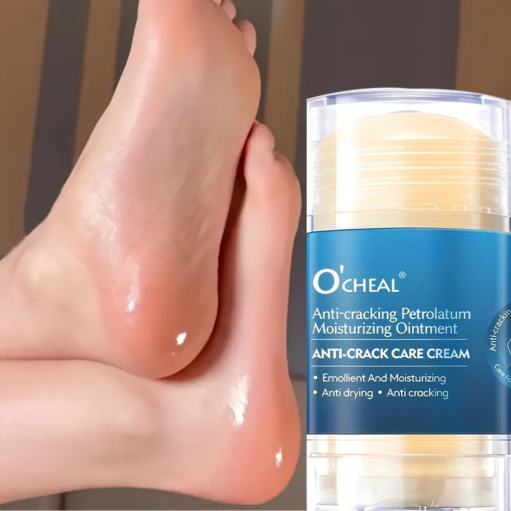 Anti-Crack Foot Cream – Deep Moisturizing Heel Repair & Dry Skin Treatment