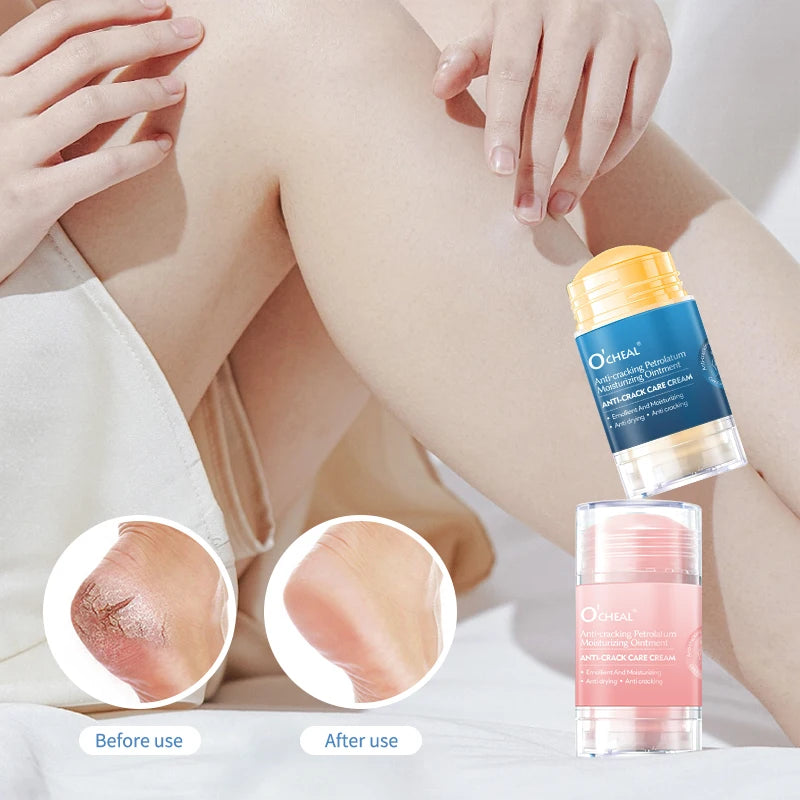 Anti-Crack Foot Cream – Deep Moisturizing Heel Repair & Dry Skin Treatment